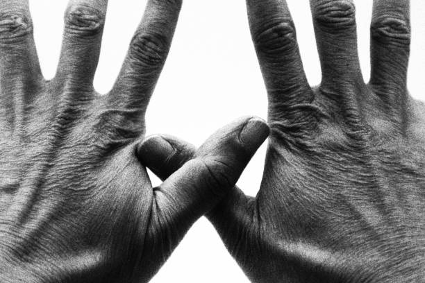 Photo of person with dry skin