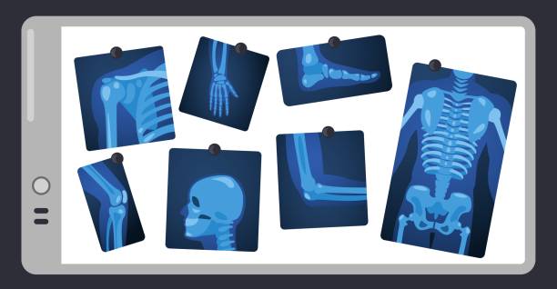 ilustrações de stock, clip art, desenhos animados e ícones de x ray on doctor screen. human skeleton parts on surgery light pad, body parts medical x-ray concept. vector illustration. bone injuries, healthcare. skull, leg, knee and chest scan pictures - human bone the human body healthcare and medicine human skeleton