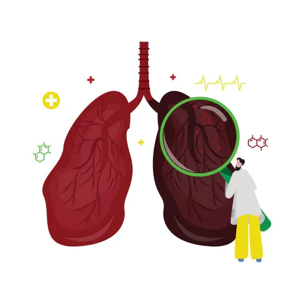 Vector illustration of lung body organ anatomy unhealthy disease respiratory system human breath and doctor holding magnifying glass search tool