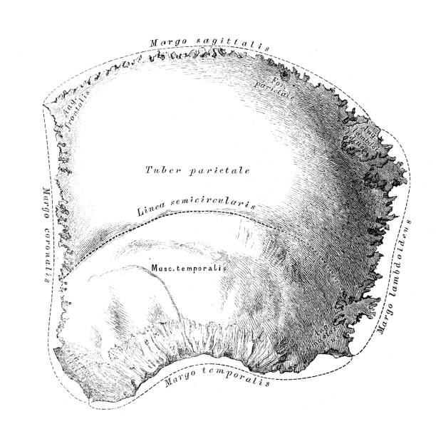 High Parietal Parietal Bone Anatomy