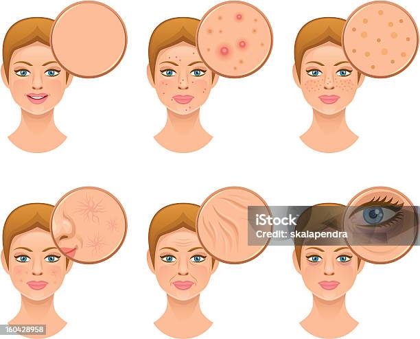 Problem Skin Stock Illustration - Download Image Now - Wrinkled, Human Skin, Acne