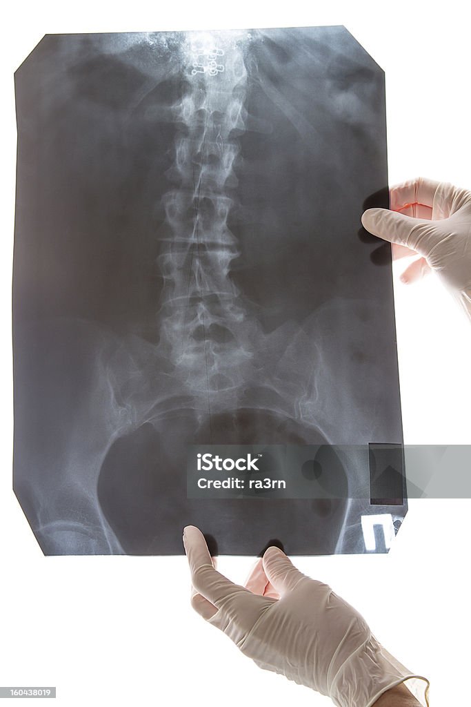 Wirbelsäule X-ray Bild auf Weiß - Lizenzfrei Anatomie Stock-Foto