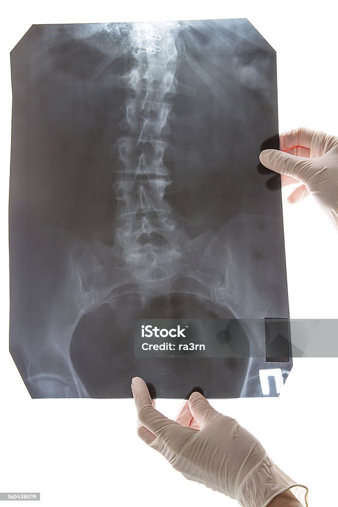 Imagem de raio-X da coluna em branco - Royalty-free Anatomia Foto de stock