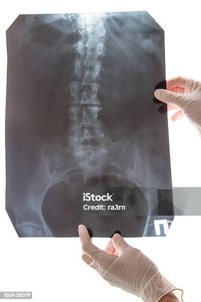 Imagem De Raiox Da Coluna Em Branco - Fotografias de stock e mais imagens de Anatomia - Anatomia, Cirurgião, Coluna vertebral humana