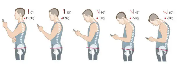 Vector illustration of Skeletal diagram of neck tilt angle and load, hunchback and posterior pelvic tilt