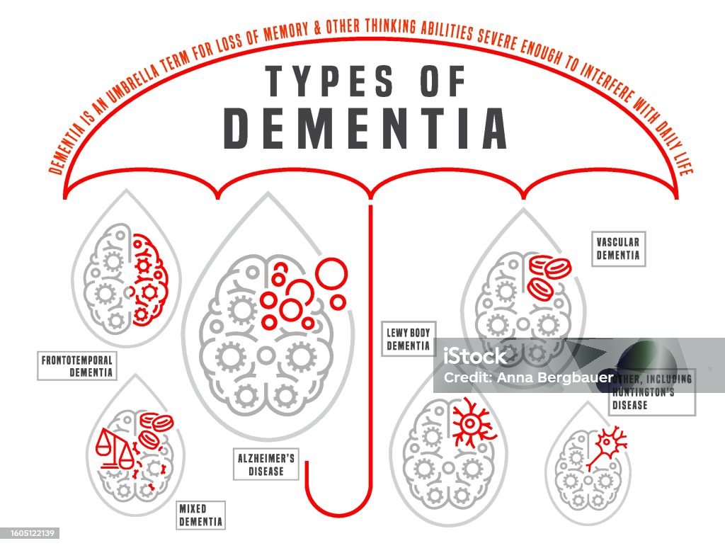 Vector Dementia Infographic In Outline Style Medical Editable