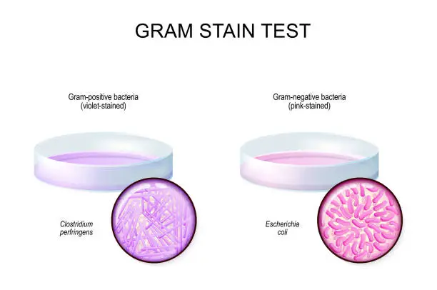 Vector illustration of Gram stain test. glass Petri dish with culture Gram-negative and Gram-negative bacteria