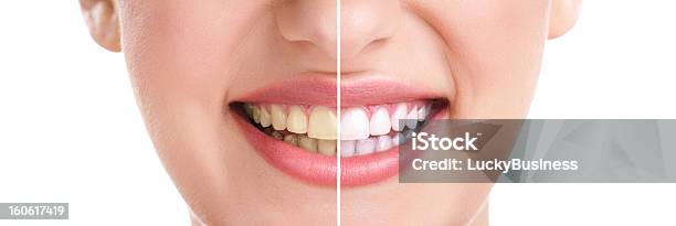 Close Up Of Smiling Woman Showing White Teeth Stock Photo - Download Image Now - Yellow, White Color, Human Teeth