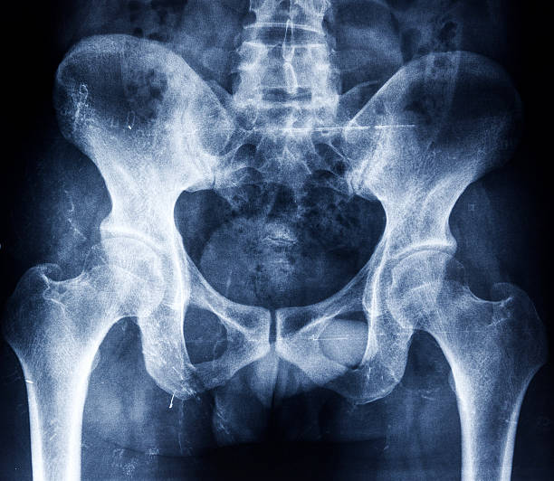 X-ray of a human pelvis showing bones human Pelvis x-ray coccyx photos stock pictures, royalty-free photos & images