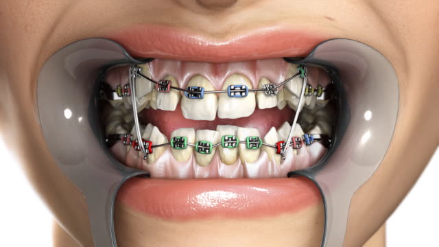 Bác sĩ chỉnh răng