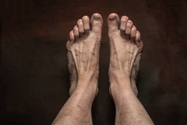 istock nail fungus infection 1606603342