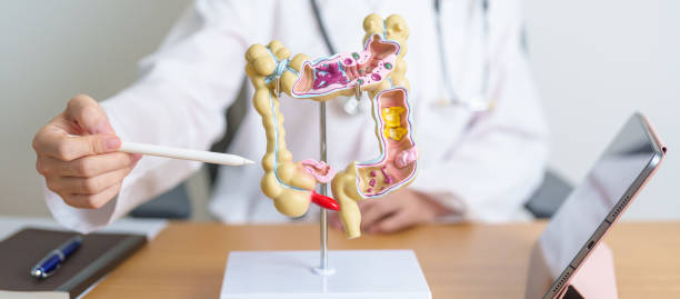 人間の結腸解剖学モデルとタブレットを持つ医師。大腸疾患、大腸がん、潰瘍性大腸炎、憩室炎、過敏性腸症候群、消化器系 - descending colon ストックフォトと画像