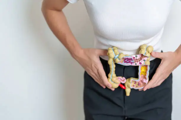 Photo of Woman holding human Colon anatomy model. Colonic disease, Large Intestine, Colorectal cancer, Ulcerative colitis, Diverticulitis, Irritable bowel syndrome, Digestive system and Health concept