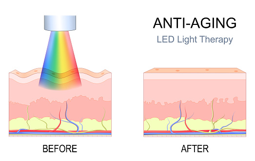 anti aging LED light therapy. Cross section human skin with wrinkles before procedure, and beautiful skin after rejuvenation therapy. face therapy in SPA resort. Vector illustration