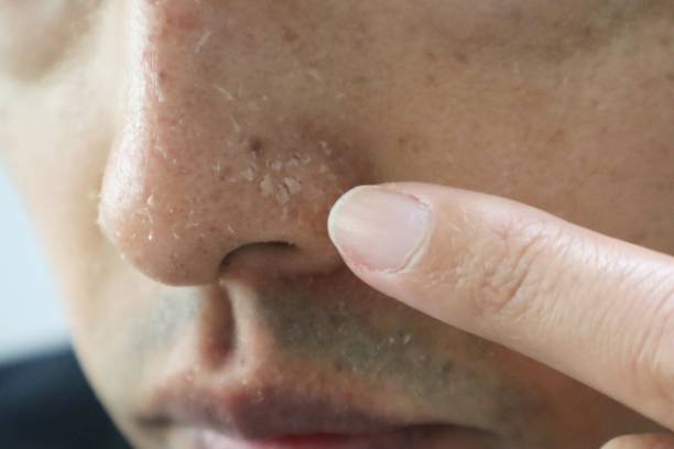istock A person pointing to a rough nose 1607562425