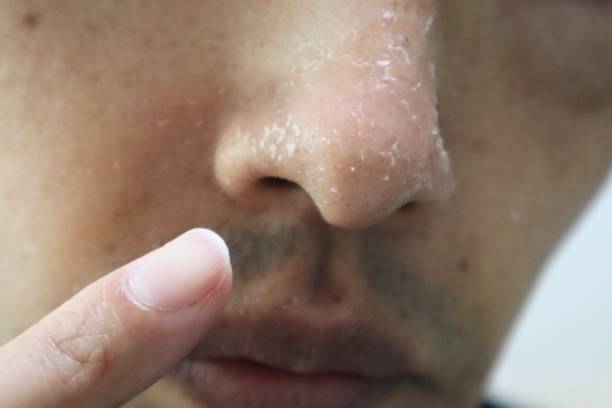istock A person pointing to a rough nose 1607566353