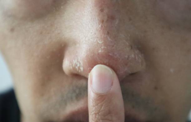 istock A person pointing to a rough nose 1607579374