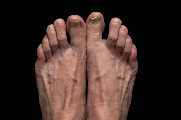istock Feet of man in front 1607594580