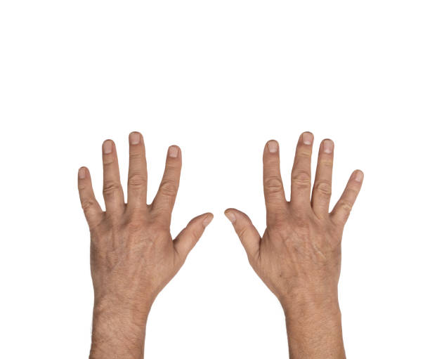 istock the backs of a man's hands 1607622378