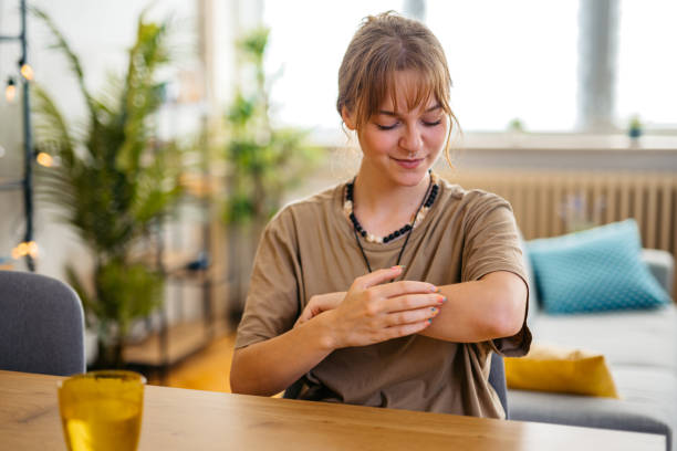 Woman Suffering From Skin Allergy Scratching Her Forearm Young woman suffering from skin allergy, scratching her forearm. photo psoriasis stock pictures, royalty-free photos & images