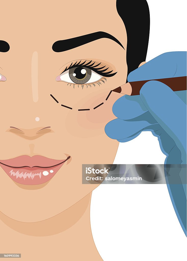 Cosmétique injection de botox - clipart vectoriel de Injection de toxine botulique libre de droits