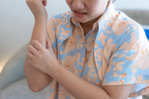 Asian woman scratching her arm, Itching from allergies, Skin disease.