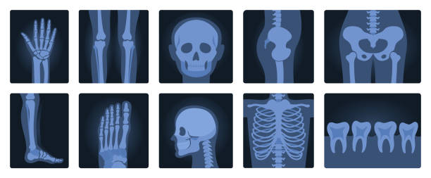 인체 세트의 엑스레이 필름, 방사선 촬영 및 해부학을 위한 의료 뢴트겐 스캔 - human lung x ray image x ray human spine stock illustrations