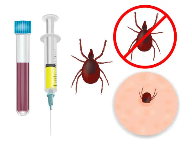 Vector illustration of Tick-borne encephalitis vaccination.Tick bite protection Vaccination against ticks. Prevention of infections transmitted by parasites