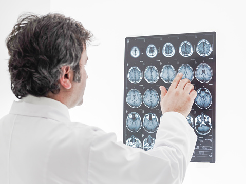 Medical doctor analyzing a CT scan. Scan of the patient with a problem in his brain.