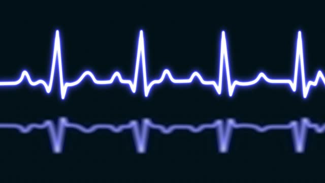 Blue neon heartbeat with love shaped isolated on blue grid background. Medical concept and ecg pulse line graph