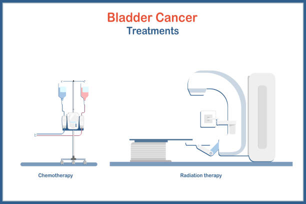 leczenie raka pęcherza moczowego - linear accelerator stock illustrations