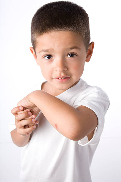istock Hispanic Boy Shows Wound on His Elbow 161372944