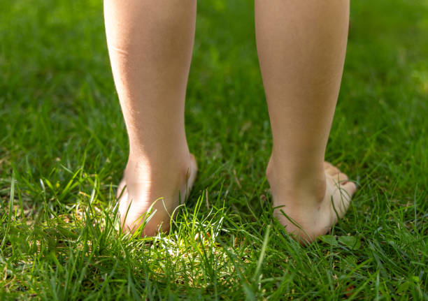 istock kid legs in park with mosquito insects bites 1613987011