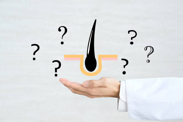 istock Doctor's hand and hair illustration with question marks 1615795612