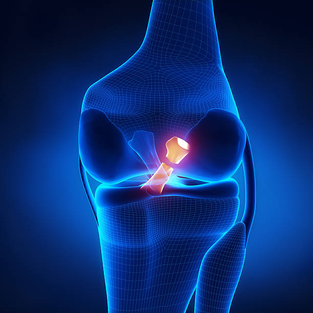 istock Torn Posterior Cruciate Ligament 161714793
