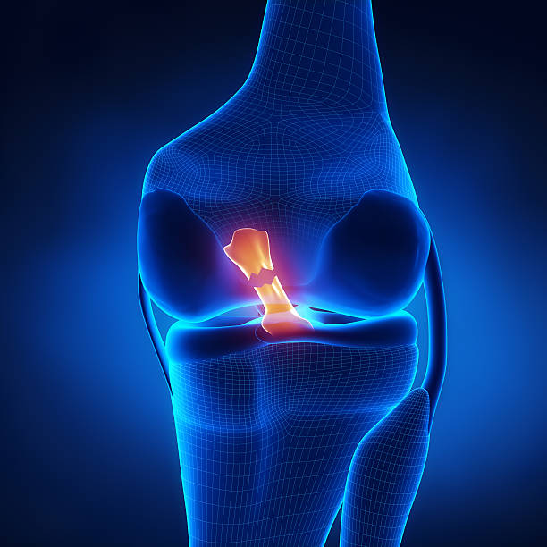 rasgado ligamento cruzado anterior - ligament fotografías e imágenes de stock