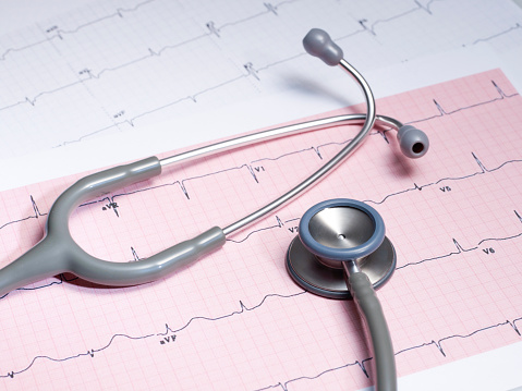 A stethoscope on a printout of a cardiogram Chart (ECG)