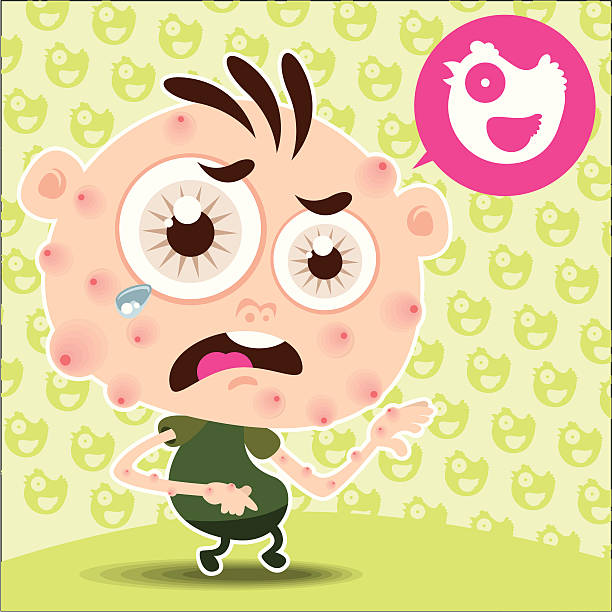 Chickenpox Graphics 80+ Chicken Pox Teen Stock Illustrations, Royalty-Free Vector Graphics ...