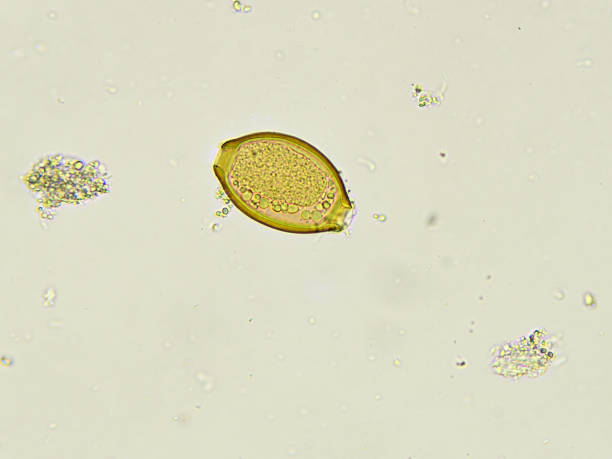 istock Egg of Trichuris trichiura (whipworm) 1619032276