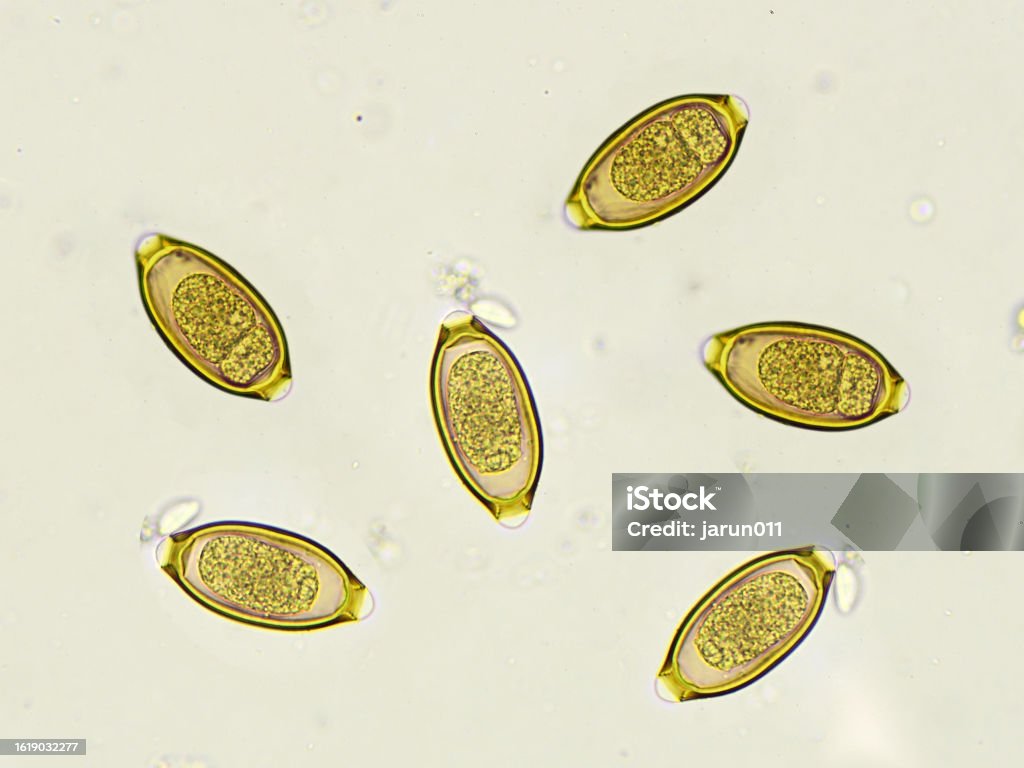 Egg of Trichuris trichiura (whipworm) - Royalty-free Ampliação Foto de stock Egg of Trichuris trichiura (whipworm) - Royalty-free Ampliação Foto de stock