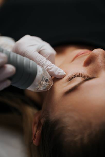 istock Microneedle RF lifting procedure. Hardware cosmetology. 1619690138