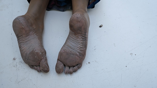 Close up of man feet on floor illustrating homeless dead people