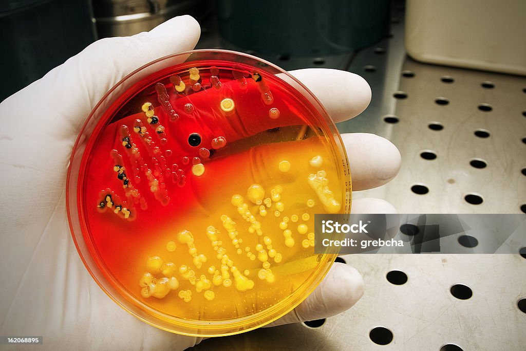 Mano agarrando una placa de petri - Foto de stock de Agar-agar libre de derechos
