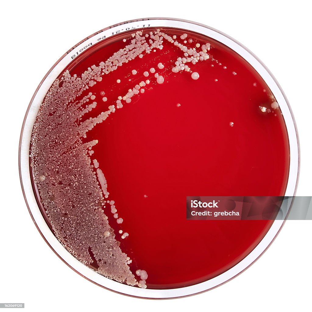 Bactéries colonies sur Gélose au sang - Photo de Bactérie libre de droits