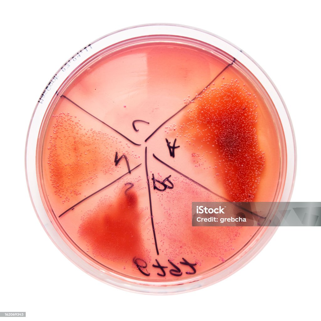 세균 집락이 on 페트리 접시 - 로열티 프리 0명 스톡 사진