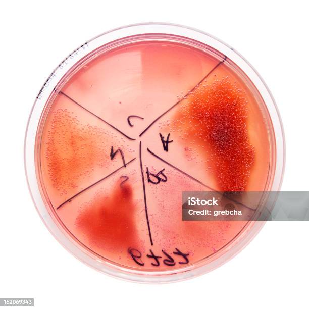세균 집락이 On 페트리 접시 0명에 대한 스톡 사진 및 기타 이미지 - 0명, 건강관리와 의술, 과학