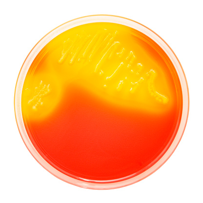 Bacteria colonies on petri dish, isolated on white