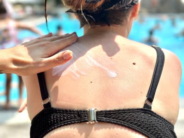 istock The girl's hands smear sunscreen on her back. Sunburn protection. 1620817154