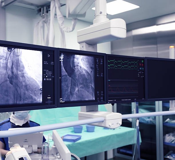x-ray écrans - angioplasty photos et images de collection