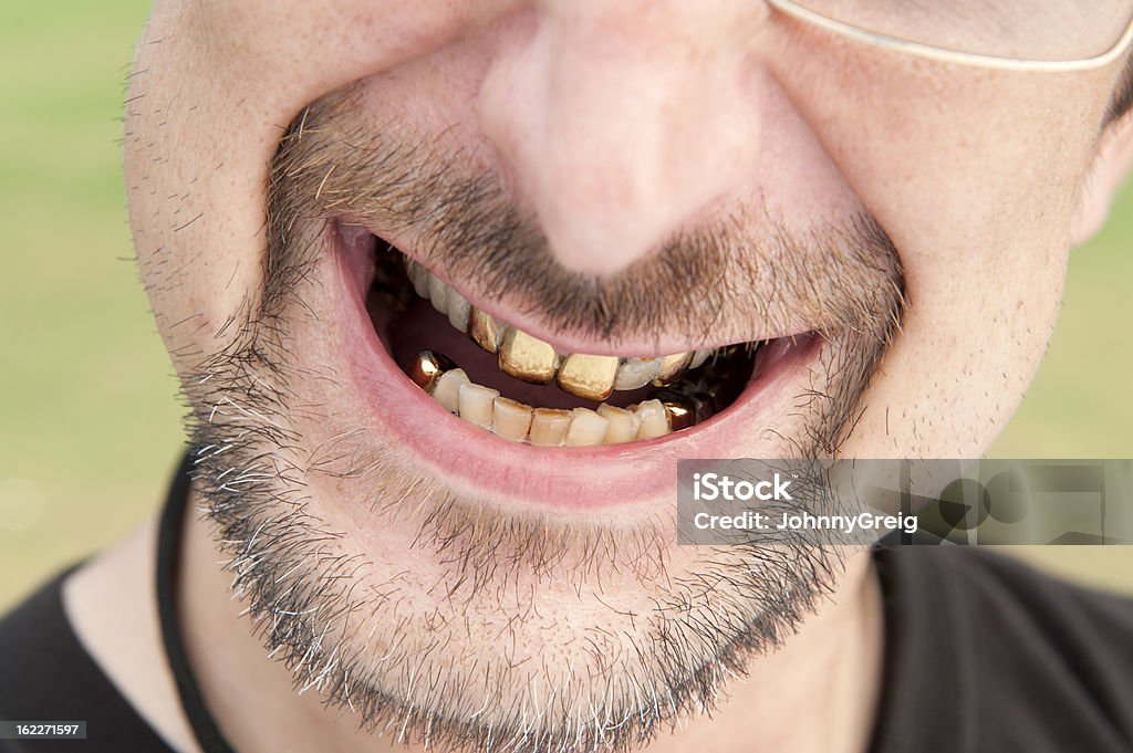 Gold Teeth Gold teeth grimace close up Gold Tooth Stock Photo